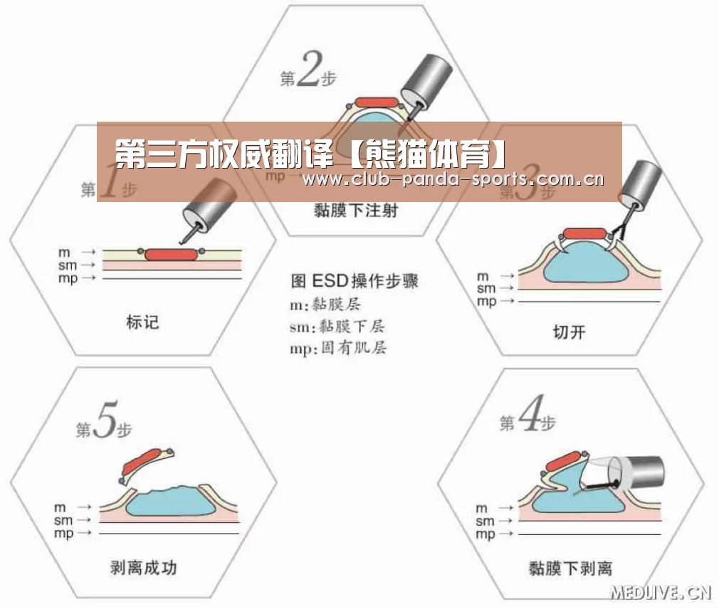 第三方权威翻译【熊猫体育】(图1) 熊猫娱乐